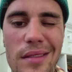 Justin Bieber kertoo videolla, mistä hänen kasvohalvauksensa johtuu