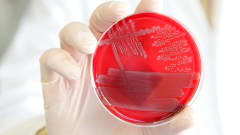Laboratoriotyöntekijä pitelee viljeltyä EHEC-bakteerikantaa sisältävää petrimaljaa.