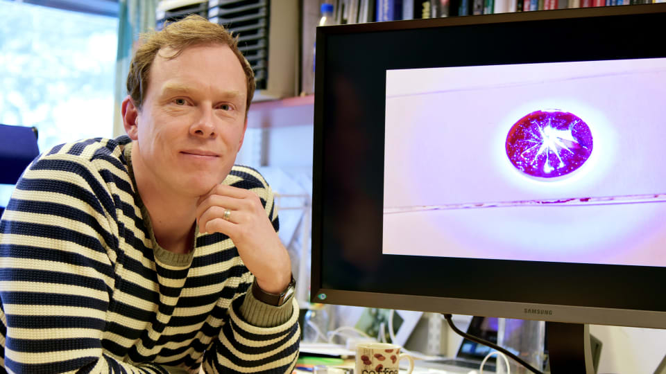 melko mustat naiset kuvia