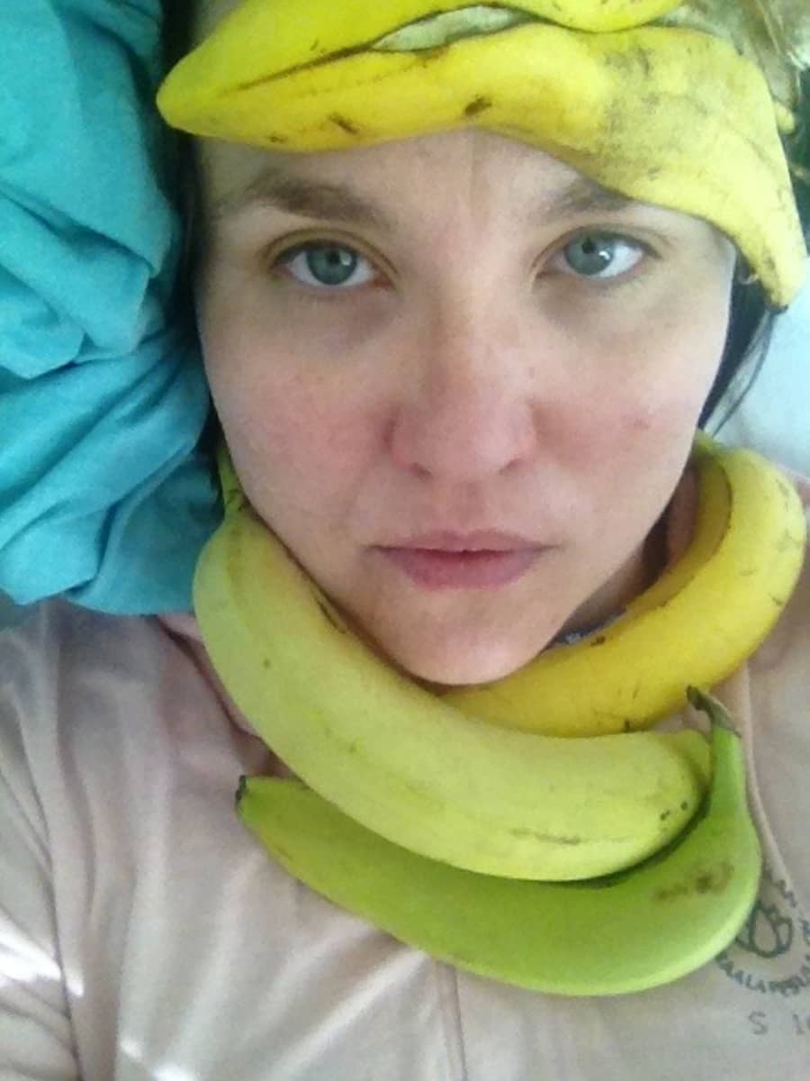 Maaria Oikarinen koristeli itsensä banaaneilla sairaalassa.