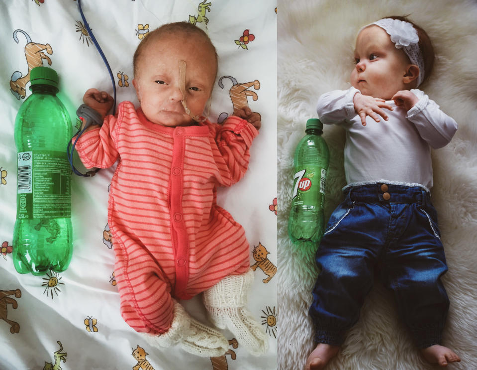 Hilda Tolonen vastasyntyneena juomapullon vieressä ja vuoden kuluttua suurempana saman juomapullon vieressä.